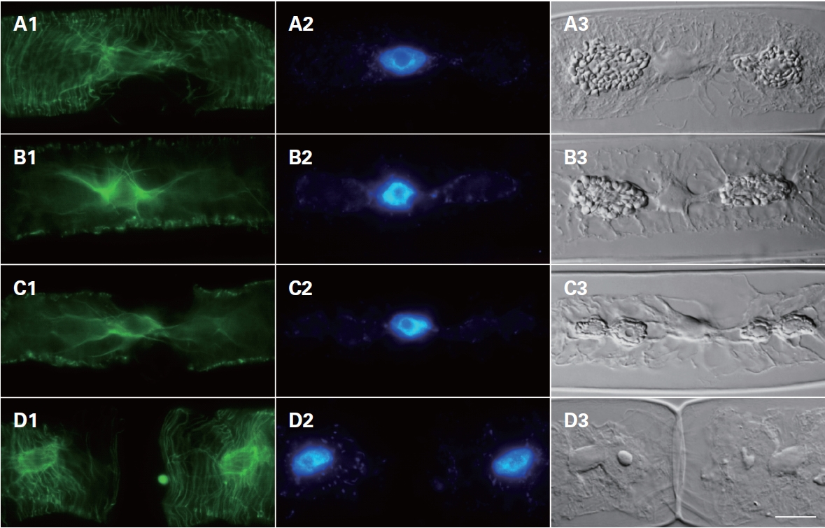 Fluorescein isothiocynate (FITC)-anti-α-tubulin stained microtubulin of Zygnema cruciatum during cell division. (A) Interphase. (B) Prophase. (C) Metaphase. (D) Telophase. (A1-D1) FITC-anti-α-tubulin stained microtubulin. (A2-D2) DAPI stained nucleus. (A3-D3) Differential interference microscopic image. Scale bar represents: 10 ㎛.