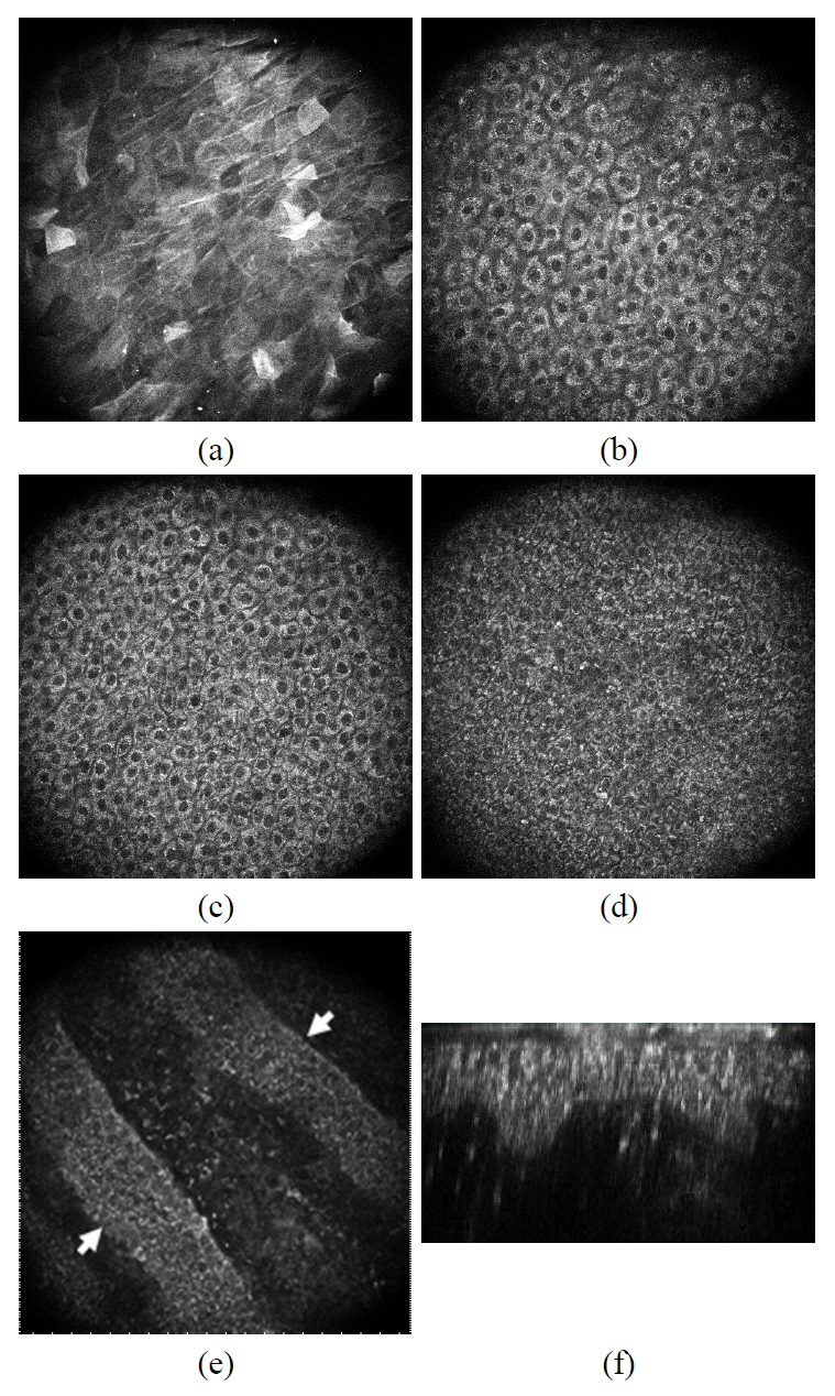 En face image of ex vivo human skin observed with two-photon microscopy. (a) Skin surface (b) 10 μm deepfrom the surface (c) 20 μm deep from the surface (d) 30 μm deep from the surface (e) 40 μm deep from the surface and (f) B-scan image of the human skin.