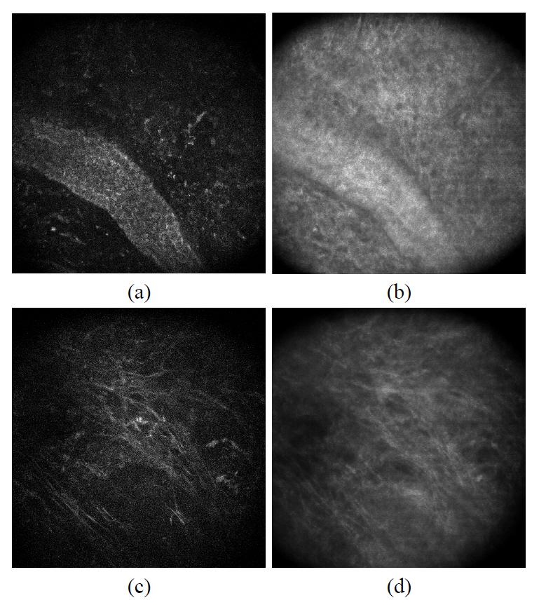 En face image of dermal fibrous structures. (a) Image of collagen fiber bundle (two-photon microscopy) (b) Image of collagen fiber bundle (confocal microscopy) (c) Image of elastic fibers(two-photon microscopy) (d) Image of elastic fibers (confocal microscopy).