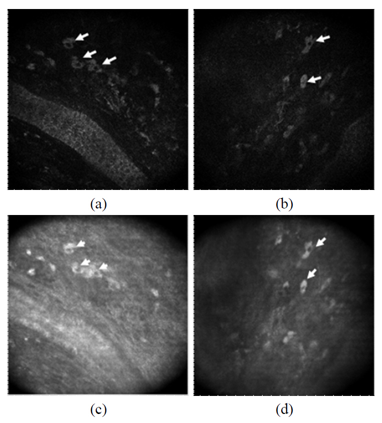 En face image of dermal cells. (a) (b) Images of dermal cells (two-photon microscopy) (c) (d) Images of dermal cells (confocal microscopy).