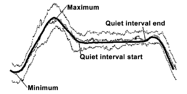 Schematic diagram of H-component (top to bottom: 1st quartile mean median and 3rd quartile).