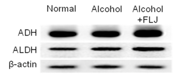 Effects of fermented Laminaria japonica (FLJ) on the hepatic alcohol dehydrogenase (ADH)and aldehyde dehydrogenase (ALDH) mRNA expressions in alcohol-induced hepatic damaged rats.