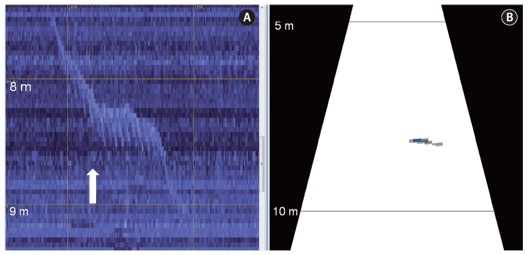 Echogram of tail-beat pattern. The ping number of 1119 was marked by a white arrow on the single target echogram (A step 8 in Fig.1 ) and is the current ping on its corresponded image smoothed echogram (B step 4 in Fig.1 ).