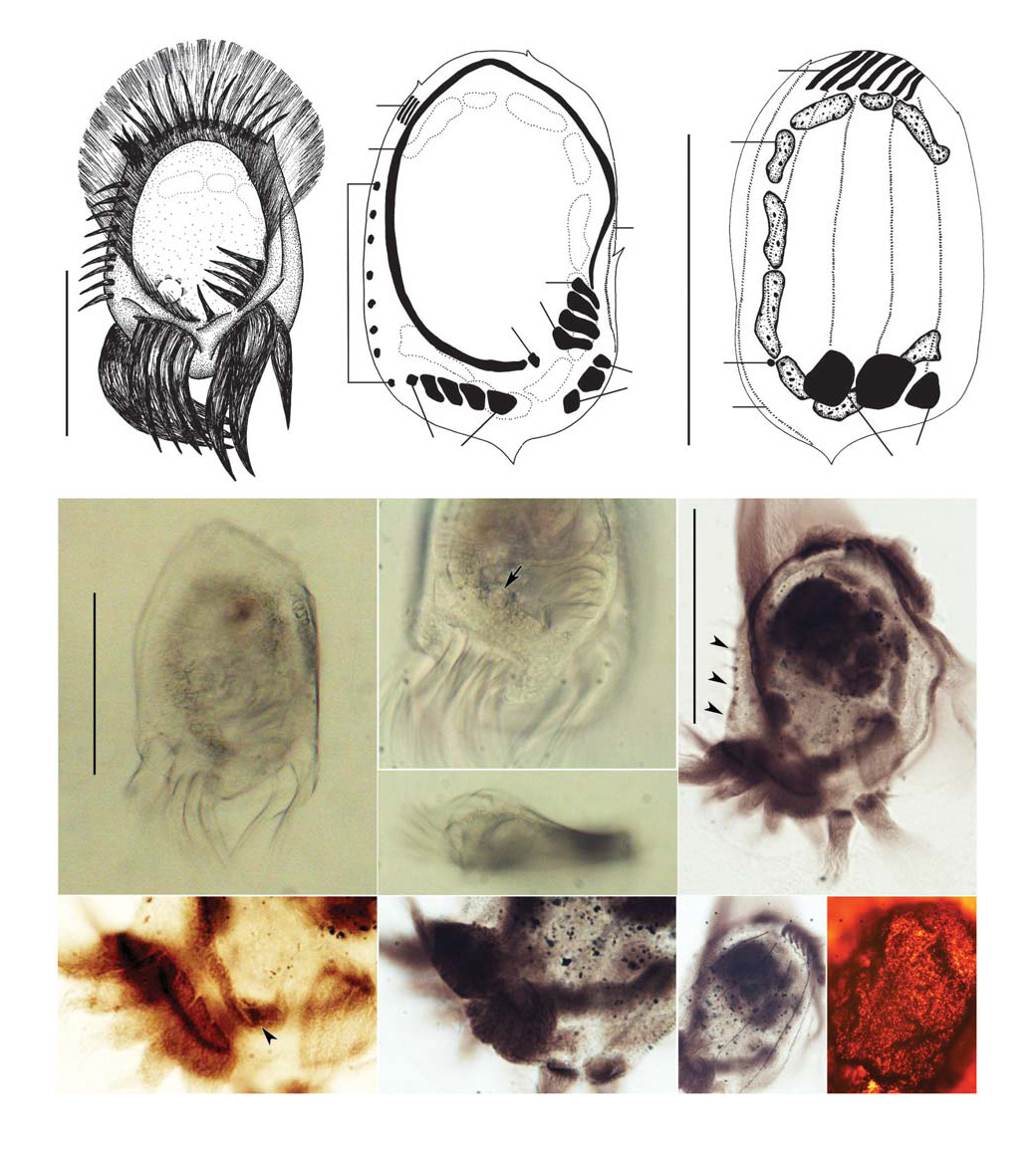 Morphological characteristics of Uronychia multicirrus. A Ventral view of a typical individual; B C The cirri pattern on the ventral (B) and dorsal (C) side drawn from protargol stained specimens; D-F Living specimens shows CV (arrow in E) and lateral side (F); G Ventral region views Ma several VC (arrowheads) and PM; H I Posterior region shows AZM2 BC (arrowhead in H)CC DK and TC; J K Dorsal side views DK (J) and silverline system (K). AZM adoral zone of membranelles; BC buccal cirrus; CCcaudal cirri; DK dorsol kineties; FC frontal cirri; LMC left marginal cirri; Ma macronuclear nodule; Mi micronucleus; PM paroral membrane; TC transverse cirri; VC ventral cirri. Scale bars: 100 μm.