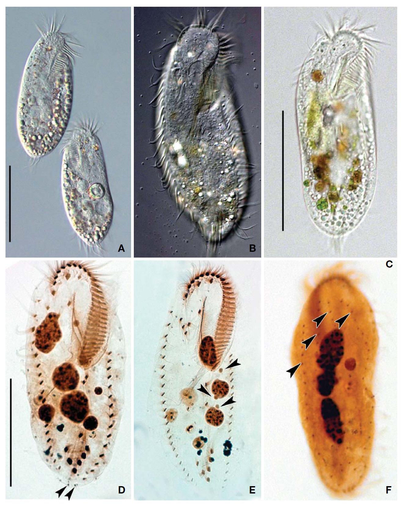Photomicrographs of Sterkiella thompsoni from live (A-C) and impregnated specimens (D-F). A Ventral view of a typical individual using differential interference contrast microscopy; B Somatic ciliature on the ventral side; C Cytoplasm with many food vacuoles; D Ventral views showing infraciliature and caudal cirri (arrowheads); E Ventral views showing the infraciliature and nuclear apparatus. Arrowheads denote micronuclei; F Dorsal kineties (arrowhead). Scale bars=100 ㎛.