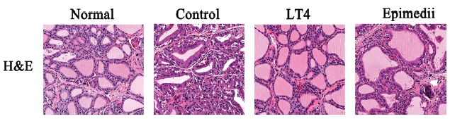 Histology of thyroid gland of Normal, Control, LT4, Epimedii-treated Hypothyroidism rats inducued by PTU. Control, PTU; T4, PTU T4; Epimedii, PTU Epimedii.