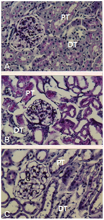 Light micrograph of kidney from normal(A), control(B), and sample(C) groups. G, glomerulus; PT, Proximal tubule; DT, distal tubule. PAS-stain x200.