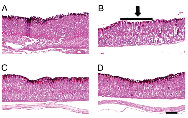 Photomicrographs of gastric mucosal tissues.