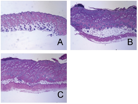 Effects of LR on histopathological changes in CD mice. Tissues were stained with hematoxylin and eosin and were observed using a light microscope. (A) Naive mice, treated with a vehicle and painted with a vehicle; (B) CD-induced control (CTL) mice, sensitized and challenged with DNFB and then painted with a vehicle; (C) Lithospermi Radix (LR)- treated CD mice, sensitized and challenged with DNFB and then painted with 10 mg/mL of LR solution for 6 days (x100).