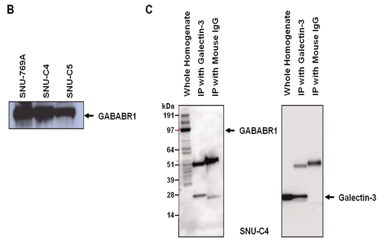 Gene and protein expressions of GABABR1 positively linked to galectin-3 expression. (A) GABABR1 in the list of the genes showing positive expressional correlation with galectin-3. (B) Protein expression of GABABR1 in the three human colon cancer cell lines tested. GABABR1 protein expression also showed positive correlation with galectin-3 expression. (C) Reverse immunoprecipitation using anti-galectin and GABABR1 antibody. Results demonstrated that two proteins did not interact to form a complex in SNU-C4 with modest expression of galectin-3 and GABABR1.