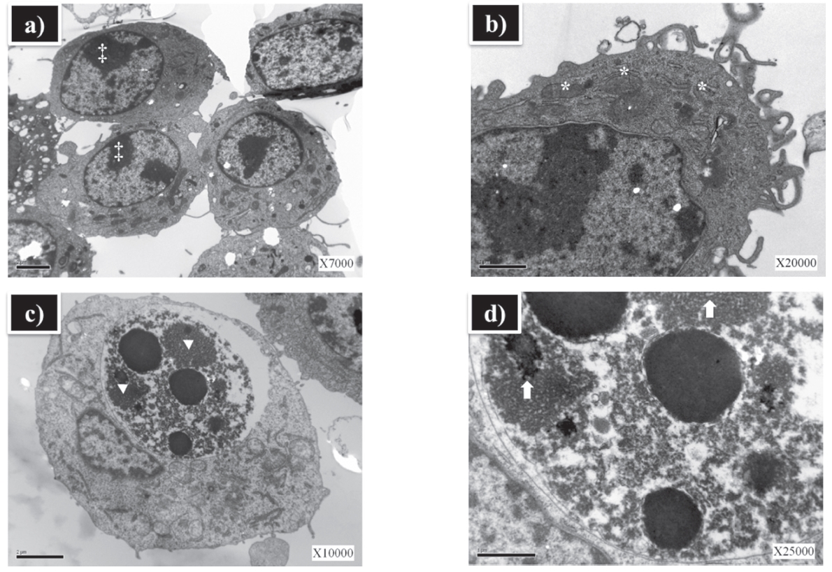 Cellular structural changes of RAW 264.7 cells treated with ZnO NPs (a, b) and ZnO NP HPPS (c, d). (a) The nucleus contains a moderate quantity of nuclear membrane-associated condensed chromatin (‡). (b) The nuclear and mitochondrial membranes are clearly outlined (*). (c-d) Large inclusions are observed in the lysosome (▼). The arrow in (d) indicates complex inclusions.