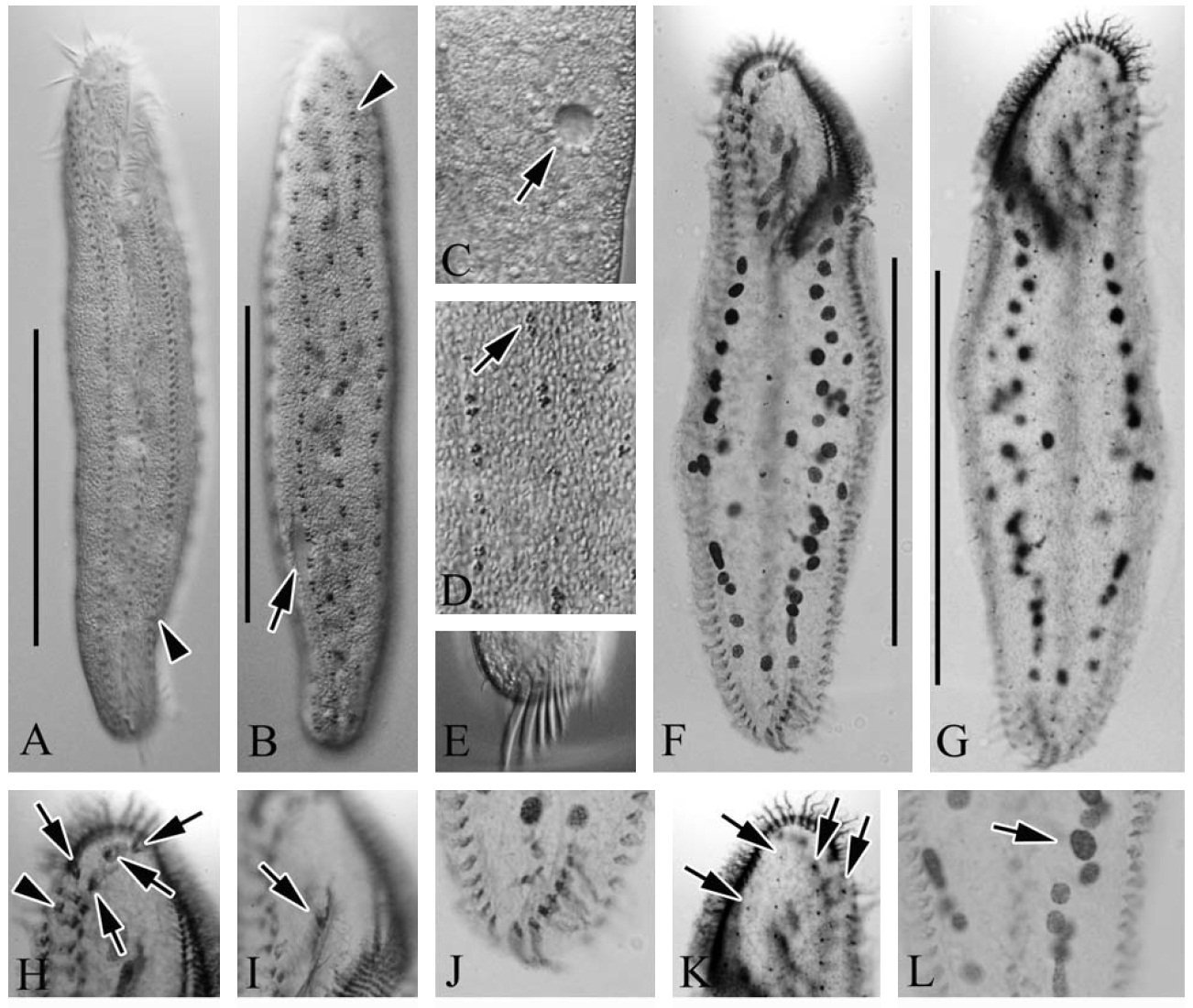 Micrographs of Anteholosticha pulchra from live (A-E) and protargol impregnated (F-L) specimens. A B Live ventral (A) anddorsal (B) view arrangement of cortical granules (arrowhead); C Ventral view contractile vacuole (arrow); D Dorsal view reddishcortical granules (arrow); E Live ventral view of transverse cirri; F G Dorsal and ventral views of protargol-impregnated specimen; H Ventral view the frontal (arrows) and frontoterminal (arrowhead) cirri; I Buccal cirri (arrow); J Ventral view the transversecirri; K Dorsal view the dorsal kineties typically four; L Macronuclear nodules (arrow). Scale bars: A B F G=100 μm.