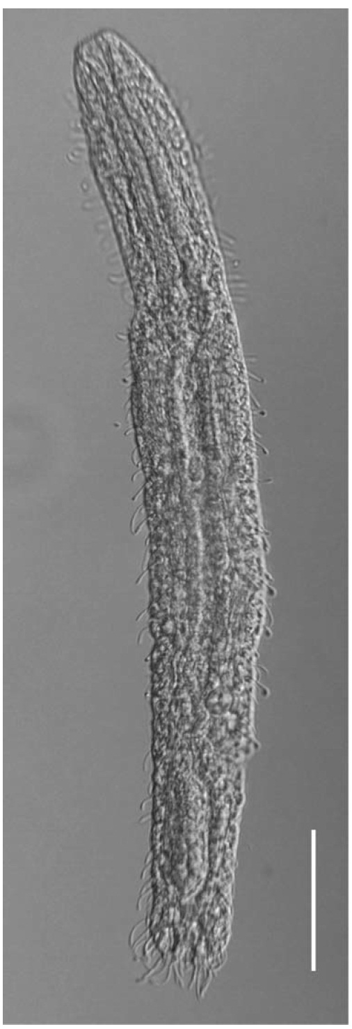 Crasiella clauseni new species habitus. Scale bar=50㎛.