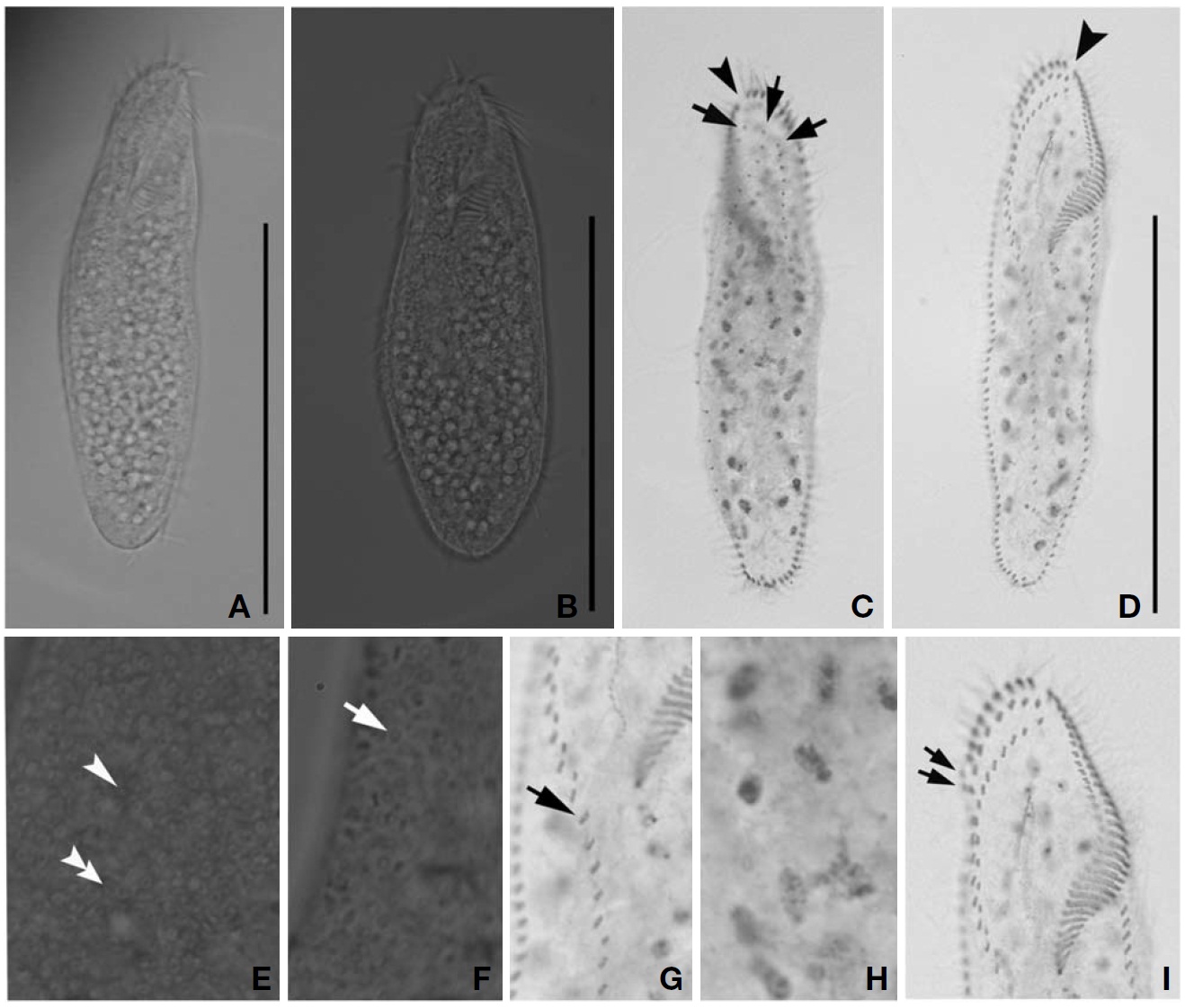 Morphology and infraciliature of Uroleptopsis citrina from live specimens (A B E F) and after protargol impregnation (C DG-I). A B Ventral views of live specimen; C Dorsal and (D G-I) ventral views of protargol-impregnated specimen; C Arrows markthe invariable three dorsal kineties; C D Arrowheads point to gap in adoral zone; D General ciliature of the specimen; E F Arrowand arrowheads indicate the two kinds of granules respectively; G Anterior pairs and single cirri (arrow mark) on the midventralcomplex; H Indicates macronucleus; I Frontal cirri (bicorona); arrows show two frontoterminal cirri. Scale bars=100 μm.