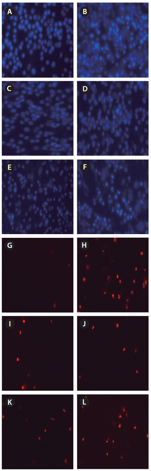Protective effect of dieckol isolated from Ecklonia cava and ascorbic acid (both 12.5 μM) on H2O2-induced cell damage in the Vero cell line. The samples were treated at 60℃ from day 0 to day 7. Cellular morphological changes were observed under a fluorescence microscope after (A-F) Hoechst 33342 and (G-L) propidium iodide double staining. (A & G) Notx. (B & H) H2O2. (C & I) Dieckol at day 0. (D & J) Dieckol at day 7. (E & K) Ascorbic acid at day 0. (F & L) Ascorbic acid at day 7.
