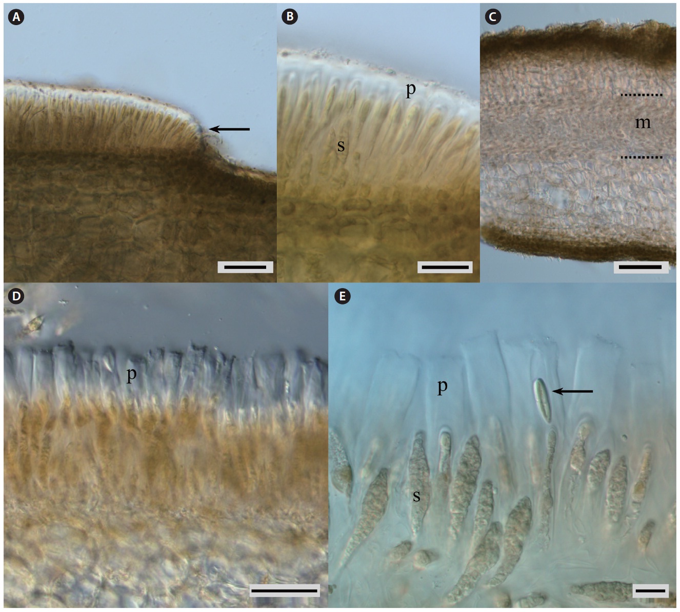 Cross-sections of fertile blades of Laminaria appressirhiza (A-C) and L. inclinatorhiza (D & E). Paraphyses of L. inclinatorhiza (D & E) have longer gelatinous caps than in L. appressirhiza (A & B). (A) Arrow points to a zone in the cortical layer where sporangia and paraphyses begin to develop. (C) Part of fertile blade of L. appressirhiza with thick medullar layer (dashed lines, m). (E) Arrow points to a diatom cell, which is inside the long gelatinous cap. p, paraphyses; s, sporangia. Scale bars represent: A, B & D, 30 μm; C, 100 μm; E, 15 μm.