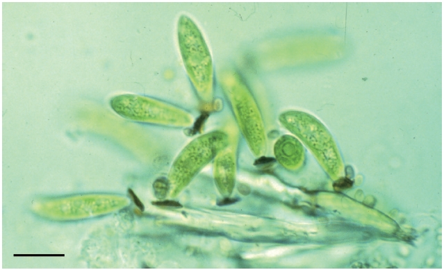 Light microscope image of Pseudocharaciopsis minuta. Scale bar represent: 10 μm.