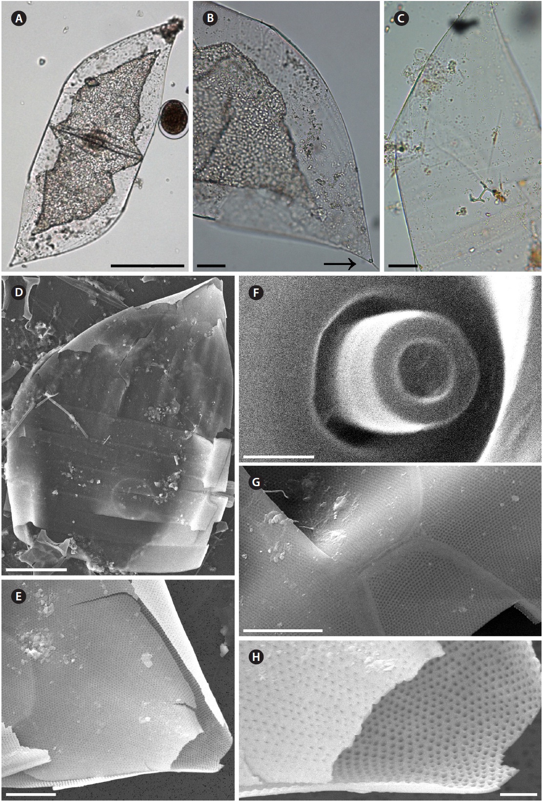 Neocalyptrella robusta. (A) A complete cell, light microscopy (LM). (B) Apical part of valve, external tube at the valve apex (arrow), LM. (C) Apical part of valve, valve with part of the cingulum, LM. (D) Apical part of valve, valve with part of the cingulum, scanning electron microscopy (SEM). (E) Striation at valve apex, SEM. (F) Valve apex showing calyptra structure and external tube, SEM. (G) Detail of cingulum; cingulum ends in an obtuse straight line, SEM. (H) Details of Fig. 3E loculate areolae, SEM. Scale bars represent: A, 100 μm; B & C, 20 μm; D, 50 μm; E & G, 10 μm; F, 0.5 μm; H, 2 μm.