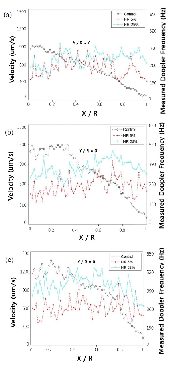 M-scan ODT flow velocity and measured Doppler frequency profiles at different flow velocity (XZ-Plane, Y=0). (a) 900 μm/s, (b) 1100 μm/s, (c) 1300 μm /s.