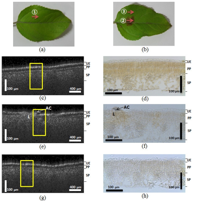 The comparison of the OCT images (left) and microscopic images of an apple leaf (right): (a) a normal leaf from a healthy tree, (b) an abnormal leaf from a diseased tree, (c) the OCT image of the normal leaf, (d) the microscopic image of the normal leaf, (e) the OCT image of a lesion on the abnormal leaf, (f) the microscopic image of the lesion on the abnormal leaf, (g) the OCT image of a normal area 6 mm from the lesion on the abnormal leaf, and (h) the microscopic image of the normal area 6 mm from the lesion on the abnormal leaf. The yellow boxes represent the corresponding histology image. (UE: upper epidermis, PP: palisade parenchyma, SP: spongy parenchyma, AC: fungus acervuli, and L: lesion area)
