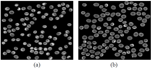 The segmented RBCs phase images. (a) Class 1: RBCs having a stomatocyte shape (b) Class 2: RBCs having a discocyte shape.