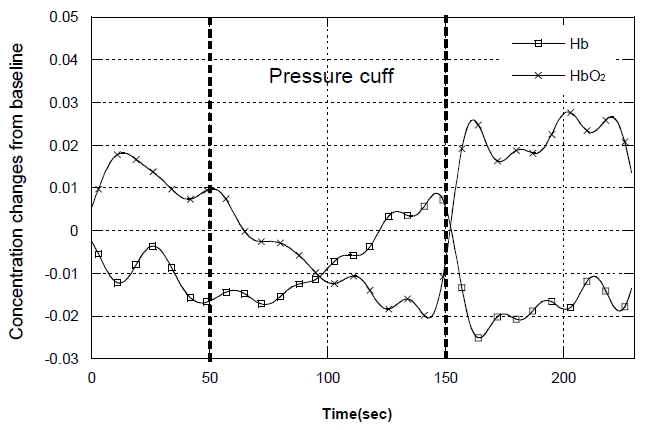 The relative changes in [HbO2] and [Hb] concentrations from the application of a pressure cuff: before, during and after the blood flow occlusion on a forearm.