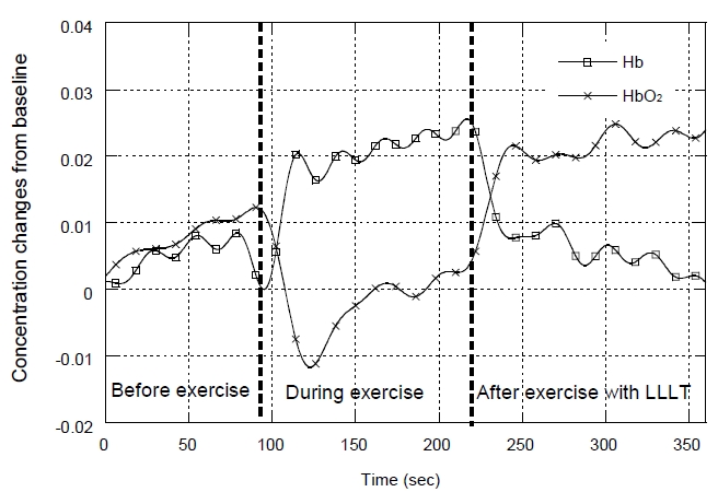 The relative changes in [HbO2] and [Hb] concentrations before, during and after exercise with LLLT application.