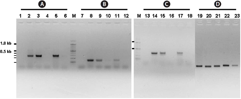 PCR amplification of the regions encoding internal transcribed spacer (ITS)-1 and ITS-2. PCR was carried out with sets of oligonucleotdes ITS1F together with ITS1R2 (A) or ITS1R1 (B), and ITS2F together with ITS2R2 (C), or ITS2R1 (D). Each lane includes PCR products amplified by using genomic DNA isolated from Ecklonia cava (1, 7, and 13), Agarum clathratum (2, 8, 14, and 19), Saccharina japonica (3, 9, 15, and 20), Undaria pinnatifida (4, 10, 16, and 21), Costaria costata (lanes 5, 11, 17, and 22), and Sargassum serratifolium (lanes 6, 12, 18, and 23). PCR were carried out with annealing temperature at 60℃ (a-c) and 65℃ (d) and products were analyzed by 1.5% agarose gel electrophoresis. Lanes M include 100 bp size markers and thick bars indicate 1.0 and 0.5 kb, respectively.