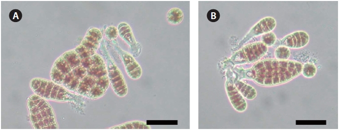 Surface view of the parent strain W1 (A) and AEC-resistant strain L130 (B) of Porphyra suborbiculata after 20 day culture in Provasoli’s enriched seawater. Scale bars: A, B = 60 μm.