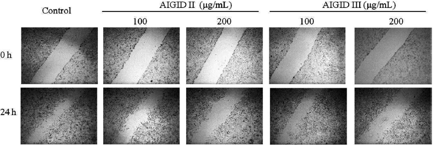 Effects of abalone intestine G I digest (AIGID) II and AIGID III on migration of HT1080 cells. After pretreatment of cells with mitomycin C (25 μg/mL) for 30 min, injury line was made on the confluent monolayer of cells. HT1080 cells were treated with AIGID II and AIGID III for 24 h. Cell motility was examined with light microscope at indicated time points.
