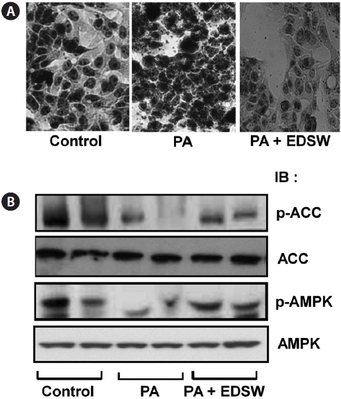 Effect of electrodialyzed desalted ground seawater (EDSW) on palmitate (PA)-induced lipid accumulation and the phosphorylation of acetyl CoA carboxylase (ACC) and AMP-stimulated protein kinase (AMPK) in HepG2 cells. Serum-starved (24 h) HepG2 cells were incubated in serum-free medium containing 10% EDSW (vol/vol) for 30 min and further treated with 0.5 mM palmitate:oleate mixture (1:2) for 24 h (A) or 2 h (B). After treatment, cells were stained with Oil Red O (A) or lysed for western blot analysis as described in ‘Materials and Methods’.