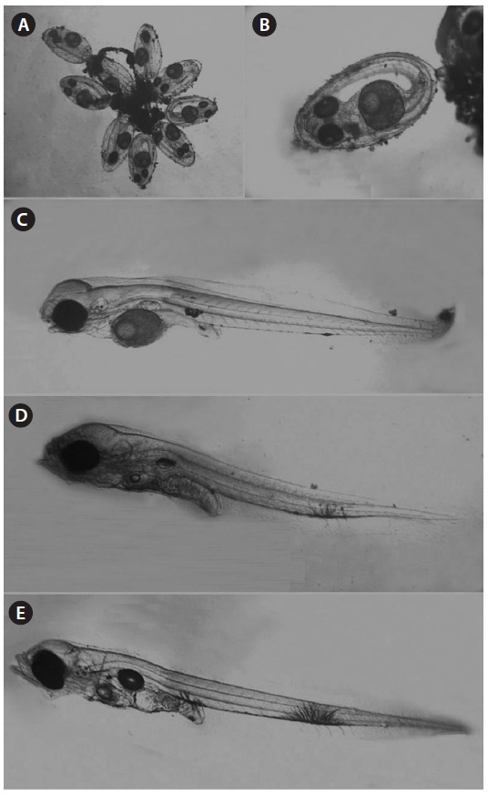 Eggs and larval development of Scartelaos gigas. (A) Egg mass (B) Embryonic stage (C) Just-hatched larva (D) Three days larva after hatching (E) Five days larva after hatching.