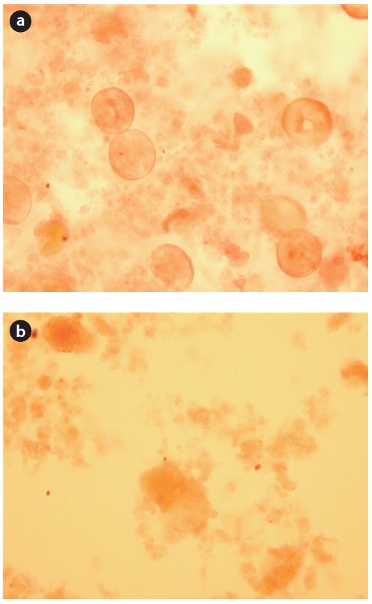 Microscopic observation (×10) at aerobic (a), non-aerobic starvation (b).