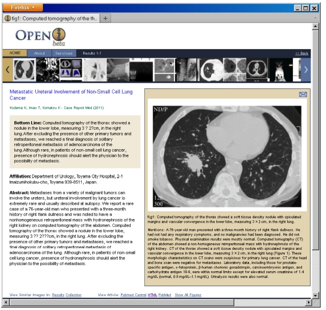 A view of an enriched citation in the user interface. The ribbon at the top allows rapid navigation to other images in the search results. The links at the bottom allow to link out to the publisher’s site, PubMed or PubMed Central, and search for similar images. Enriched citations can be sent using the email icon.