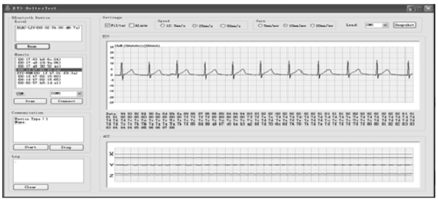 An example of user's electrocardiogram data and the present motion (accelerometer) measurements.