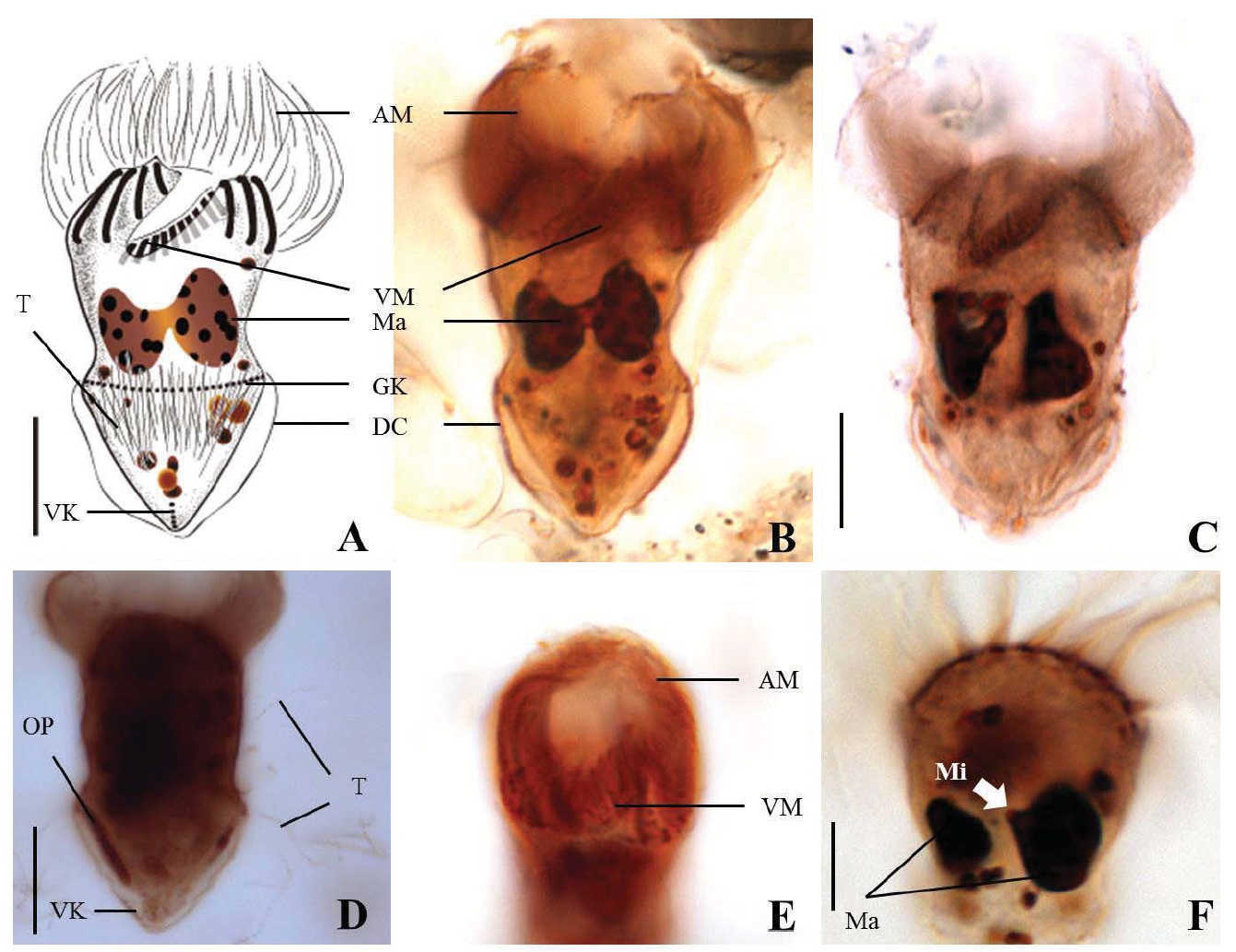 Strombidium bilobum after protargol impregnation. A-C, Ventral view; D, Lateral view, oral primordium originated below girdle part and trichites extruded from body; E, Ventral membranelles almost covered by apical collar; F, Two macronuclear nodules. AM, anterior membranelles; DC, distended cell surface; GK, girdle kinety; Ma, macronucleus (or macronuclear nodules); Mi, micronucleus; OP, oral primordium; T, trichites; VK, ventral kinety; VM, ventral membranelles. Scale bars: A, C, D, F=10 μm.
