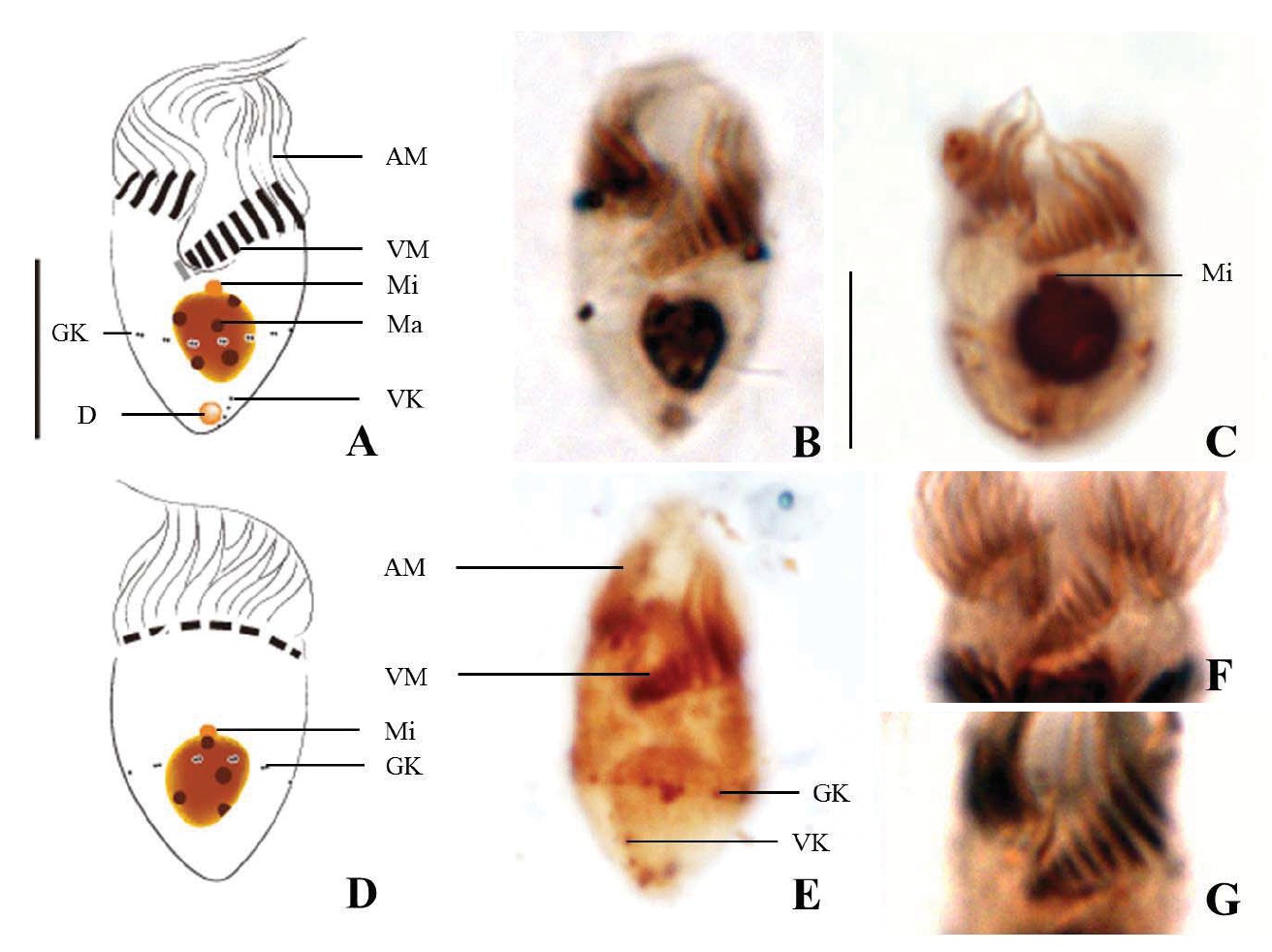 Strombidium pollostomum after protargol impregnation. A-C, E, Ventral view; D, Dorsal view; F, Arrangement of oral membranelles from S. epidemum and G, from S. pollostomum. AM, anterior membranelles; GK, girdle kinety; Ma, macronucleus; Mi, micronucleus; D, a tiny globular drop at posterior end; VK, ventral kinety; VM, ventral membranelles. Scale bars: A, C=10 μm.