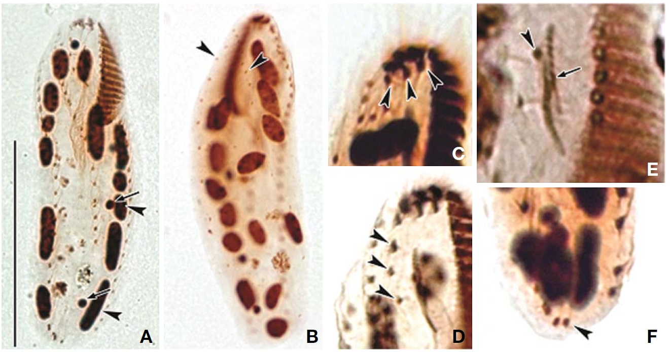 Photomicrographs of Afroamphisiella multinucleata after protargol impregnation. A, Ventral view of typical cell to indicate macronuclei (arrowheads) and micronuclei (arrows); B, Dorsal view to indicate dorsal kineties (arrowheads); C, Three frontal cirri (arrowheads); D, Frontal row cirri (arrowheads); E, Buccal cirrus (arrowhead) and undulating membranes (arrow); F, Right marginal row extending to posterior end of cell (arrowhead). Scale bar: A=50 μm.