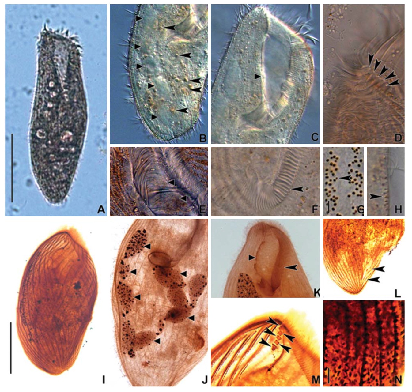 Microphotographs of Condylostoma curva from live specimens (A-H) and after protargol impregnation (I-N). A, Ventral view of a typical individual; B, Moniliform macronuclear nodules (triangular arrowheads) and cytoplasmic inclusion (arrowheads); C, Buccal field (triangular arrowhead); D, Frontal cirri (arrowheads); E, Buccal field to indicate the stripes of inner wall (triangular arrowheads); F, Proximal end of adoral zone of membranelles (arrowhead); G, Pattern of cortical granules (arrowhead); H, Lateral view of cortical granules (arrowhead); I, Ventral side view; J, Impregnated macronuclear nodules (triangular arrowheads); K, Paroral membrane (triangular arrowhead) and adoral zone of membranelles (arrowhead); L, Suture (arrowheads); M, Frontal cirri (arrowheads); N, Impregnated cortical granules. Scale bars: A, I=100 μm, G, N=5 μm.