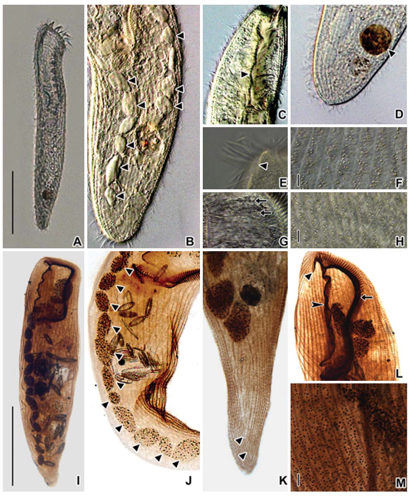 Microphotographs of Condylostoma minutum from live specimens (A-H) and after protargol impregnation (I-M). A, Ventral view of a typical individual; B, Moniliform macronuclear nodules (trianglular arrowheads); C, Paroral membrane (trianglular arrowhead); D, Food vacuole (trianglular arrowhead); E, Frontal cirrus (trianglular arrowhead); F, H, Cortical granules; G, Striated inner wall on buccal cavity (arrows); I, Ventral side view; J, Moniliform macronucleus (trianglular arrowheads); K, Suture of posterior end (trianglular arrowheads); L, To show adoral zone of membranelles (arrow), frontal cirrus (trianglular arrowhead), paroral membrane (arrowhead); M, Impregnated cortical granules between somatic kineties. Scale bars: A, I=100 μm, F, H, M=5 μm.