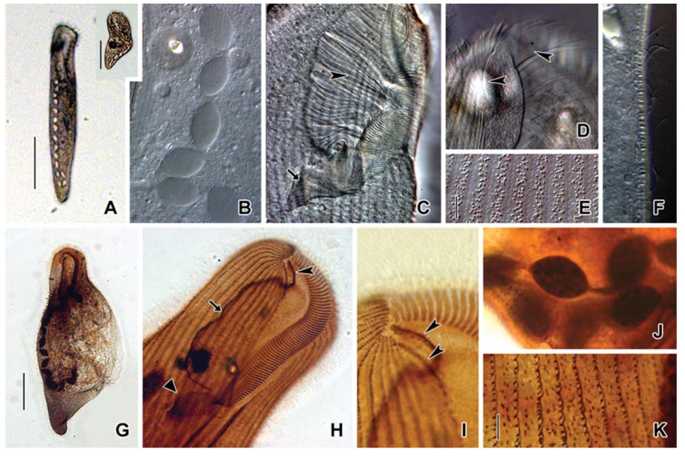 Microphotographs of Condylostoma spatiosum from live specimens (A-F) and after protargol impregnation (G-K). A, Ventral side view; B, Moniliform macronuclear nodules; C, Buccal field to indicate the stripes of inner wall (arrowhead) and the cytopharynx (arrow); D, Location of frontal cirri (arrowheads); E, Pattern of cortical granules; F, Lateral view of cortical granules; G, Ventral side view in impregnated specimen; H, Ventral view of frontal cirri (arrowhead), paroral membrane (arrow) and cytopharynx (triangular arrowhead); I, Location of frontal cirri (arrowheads); J, Macronuclear nodules and threads; K, Cortical granules in impregnated specimen. Scale bars: A=200 μm, Inset in A=200 μm, E, K=5 μm, G=100 μm.
