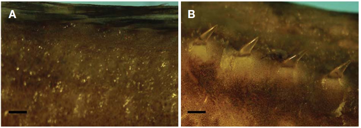 A base of dorsal fin. A, Icelus toyamenesis, NIBR-P4791; B, Icelus cataphractus, PKU 5044. Scale bars: A, B=1mm.