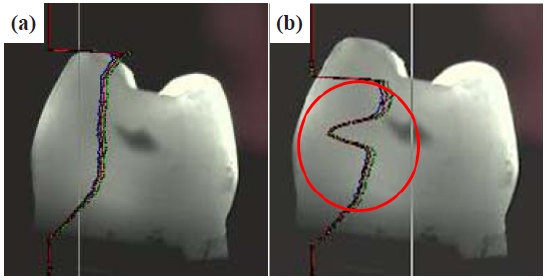 RGB distribution of sound and caries area: (a) sound area and (b) caries area.