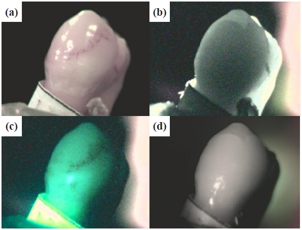 Not calcification image but stained tooth image (a) incandescent image, (b) DIFOTI image, (c) QLF image, and (d) forward IR image.