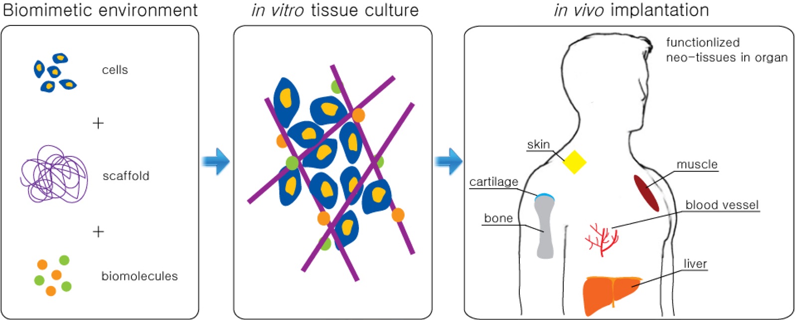 Schematics of one method of typical tissue engineering approaches.