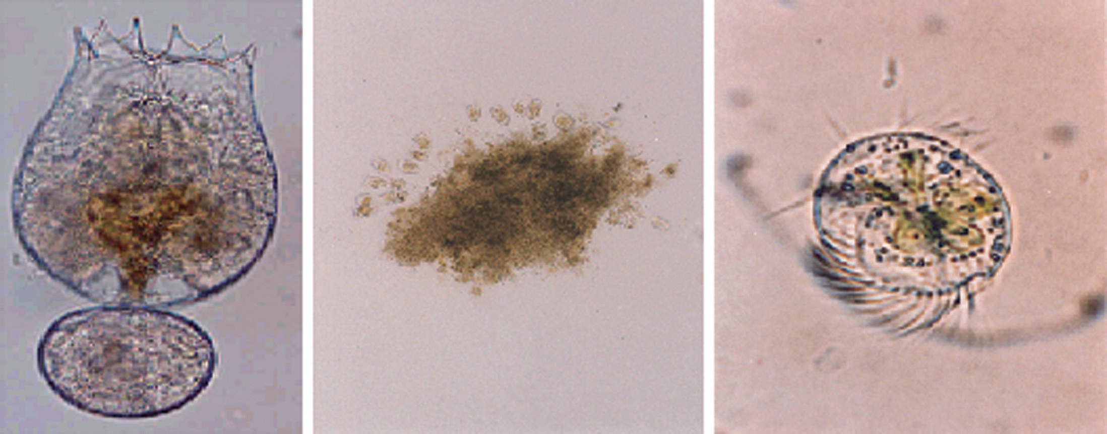 The experimental organisms of rotifer, Brachionus rotundiformis (A; 190 ± 20 μm) and two ciliates, Vorticella sp. (B; 70 ± 13 μm) and Euplotes sp. (C; 82 ± 16 μm).