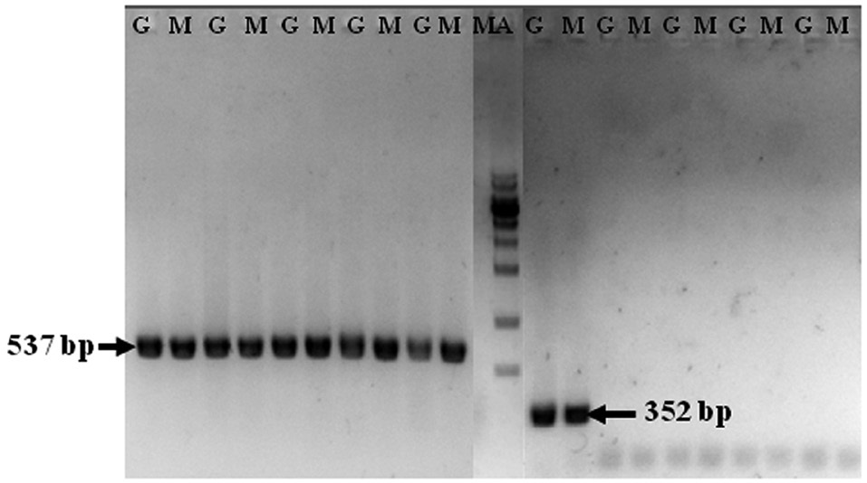 PCR analysis of ostreid herpesvirus 1 (OsHV-1) in the gill (G) and the mantle (M) of Crassostrea gigas collected from Tongyeong in August. Primary PCR was conducted with C13/C5 primer pair, and nested PCR was done with C2/C4 primer pair (right 353 bp). As a control, 18S ribosomal RNA gene was amplified with 18S-F/18S-R primer pair (left 537 bp). The figure is a part of the PCR results to show the positive band amplified with C2/C4 primer pair. MA, 1 kb ladder (Bioneer, Korea).