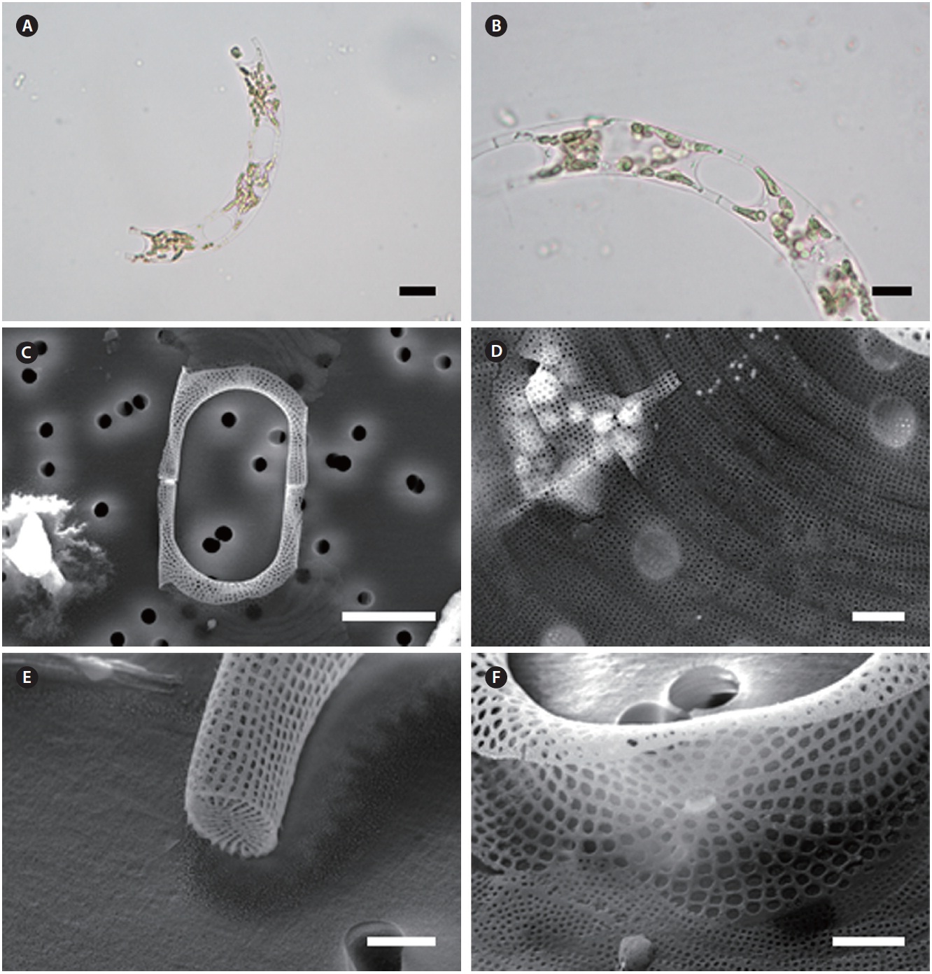 Eucampia cornuta. (A) Colony form with several small plastids, light microscopy (LM). (B) Two-celled colony, large elliptical aperture shape, LM. (C) Long and narrow cylindrical elevations, scanning electron microscopy (SEM). (D) Intercalary bands with rows of puncta, SEM. (E) Ocellus with linear ribs, SEM. (F) Labiate process on valve face in the internal view, SEM. Scale bars represent: A & B, 10 μm; C & F, 1 μm; D & E, 2 μm.