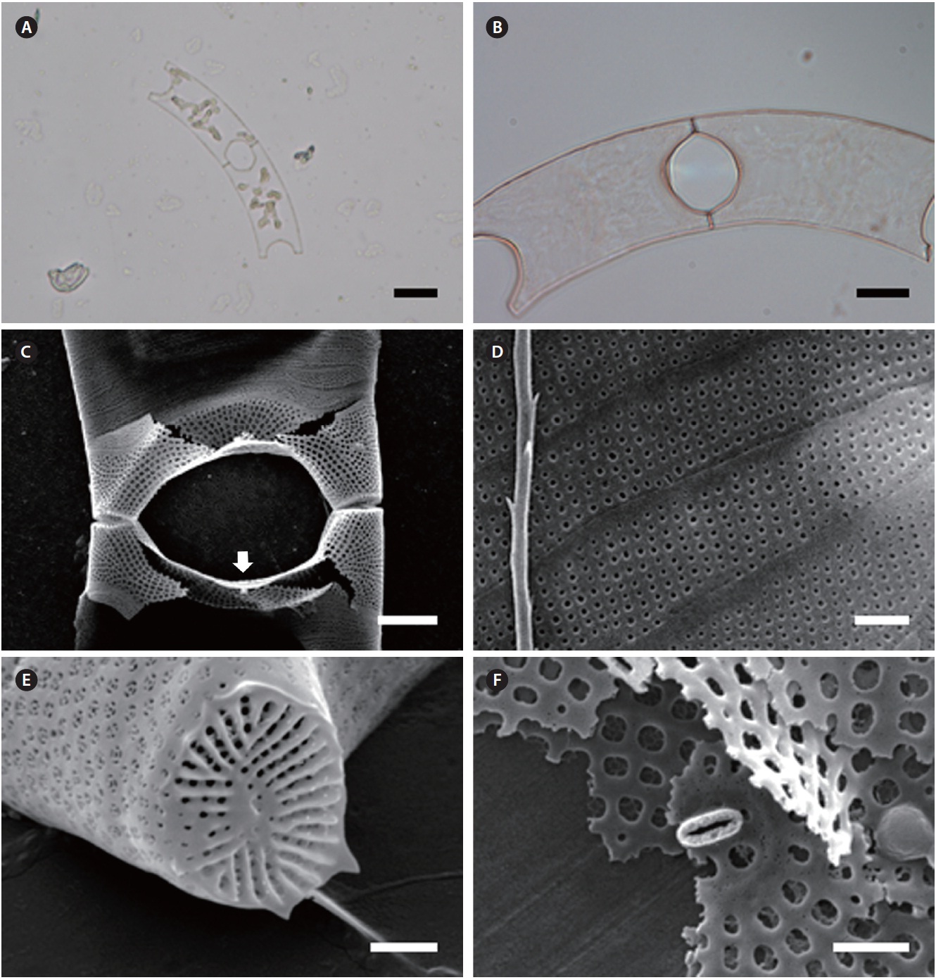 Eucampia groenlandica. (A) Two-celled colony form, cells slightly curved chain with several plastids, light microscopy (LM). (B) Almost circular to rounded rectangular aperture shape, LM. (C) Short and broad elevations with form of risen tips, labiate process (arrow) on the internal valve center, scanning electron microscopy (SEM). (D) Intercalary bands with rows of puncta, SEM. (E) Ocellus with linear ribs, SEM. (F) Labiate process, SEM. Scale bars represent: A, 20 μm; B, 10 μm; C, 5 μm; D-F, 1 μm.