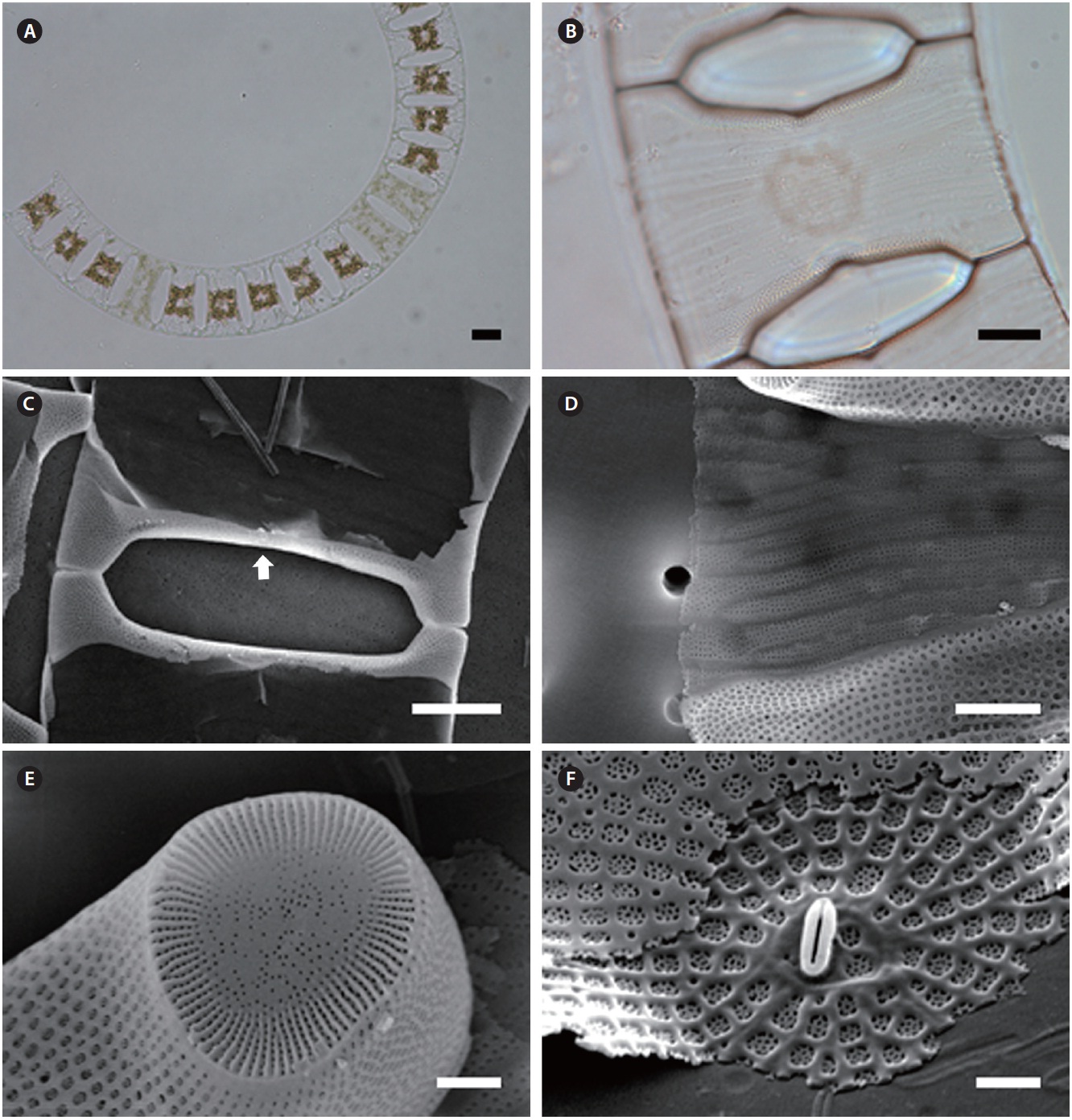 Eucampia zodiacus. (A) Colony formation, light microscopy (LM). (B) Partial colony, narrow and rounded rectangular aperture shape, LM. (C) Short and broad elevations with risen blunt tips, labiate process (arrow) on the internal valve center, scanning electron microscopy (SEM). (D) Intercalary bands with rows of puncta, SEM. (E) Ocellus with radial ribs and large central area, SEM. (F) Labiate process, SEM. Scale bars represent: A, 20 μm; B, 10 μm; C, 5 μm; D-F, 1 μm.